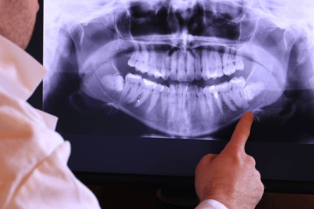 Best Tooth Infection Emergency Dentist  in Port Aransas, TX